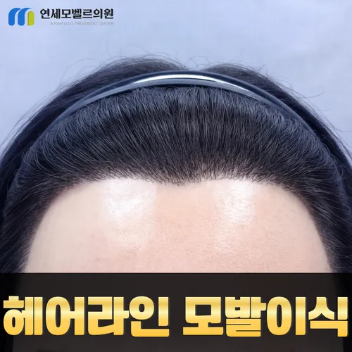 인천 연세모벨르의원 · 아름다운 얼굴선의 시작 안내 이미지